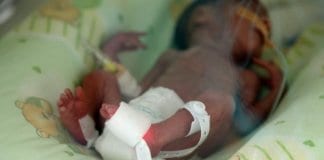 специализирани пелени за недоносени бебета