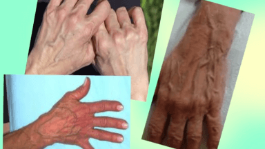 hands