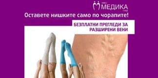 Безплатни прегледи за разширени вени