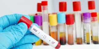 Учени елиминираха ХИВ от ДНК на мишки