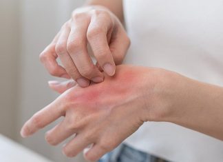 Безплатни прегледи за тежък атопичен дерматит през ноември